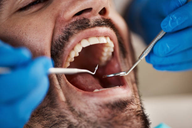 Best Emergency Treatment for Oral Infections in Social Circle, GA